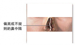 鼻部解析圖
