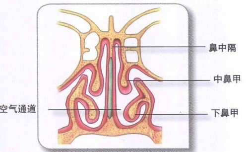 鼻中隔偏曲解析圖
