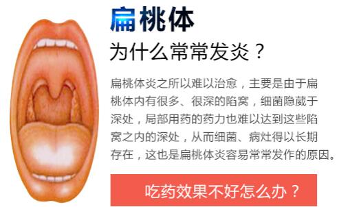扁桃體炎經常發炎的原因