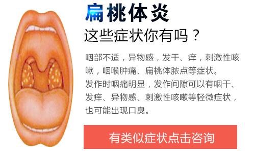 扁桃體炎的癥狀