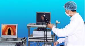 聲帶息肉的檢查設備