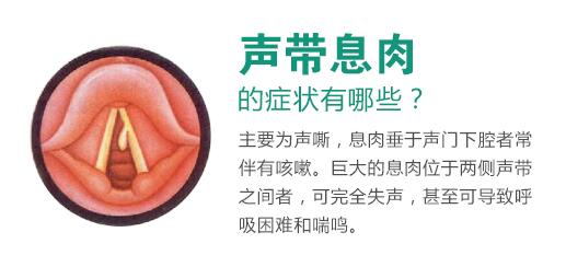 聲帶息肉的癥狀