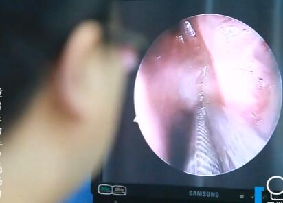 醫生檢查鼻中隔偏曲患者